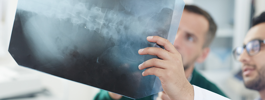 A young white doctor shows an x-ray of a human spine to his colleague.